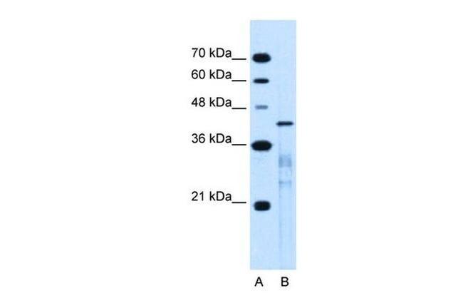 MARVELD3 Antibody in Western Blot (WB)