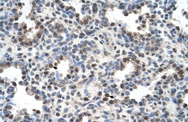 FAM134B Antibody in Immunohistochemistry (IHC)