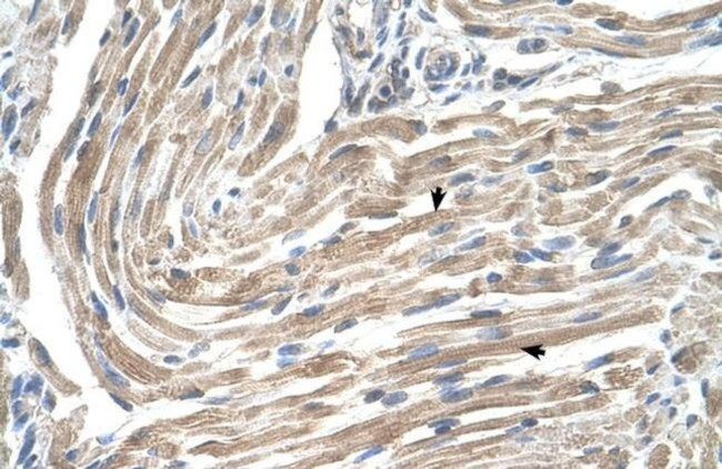 MGST2 Antibody in Immunohistochemistry (IHC)