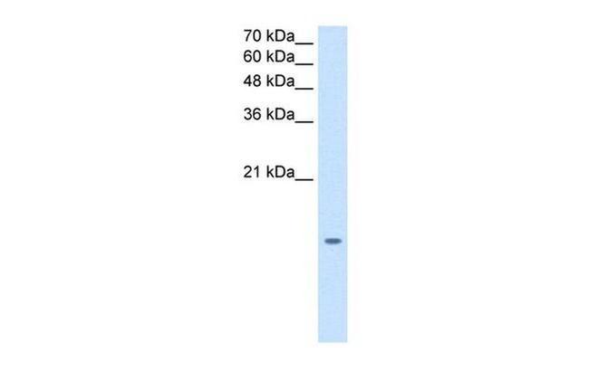 MGST2 Antibody in Western Blot (WB)