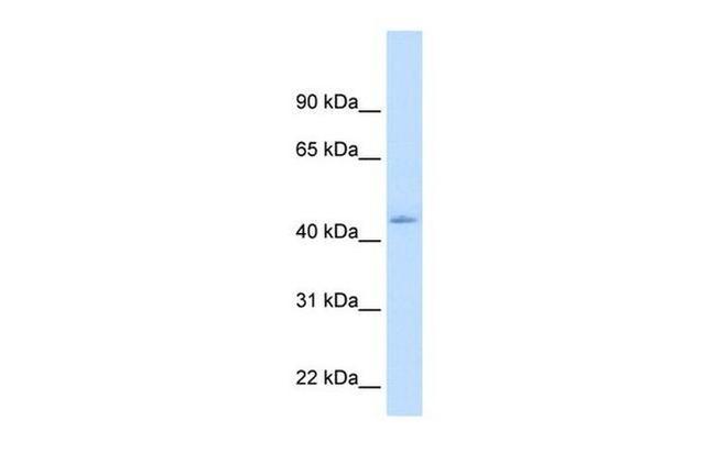 MB67 Antibody in Western Blot (WB)