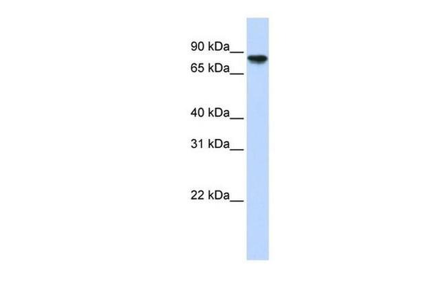 GYS2 Antibody in Western Blot (WB)