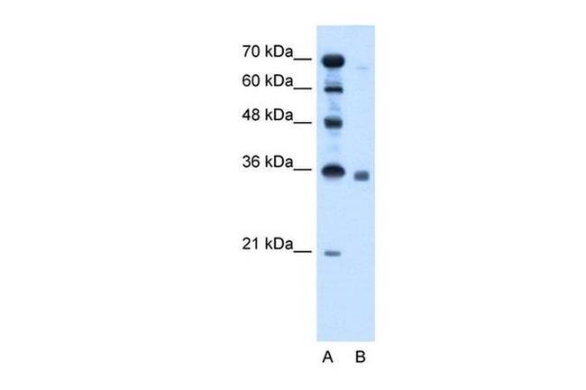SGPP2 Antibody in Western Blot (WB)