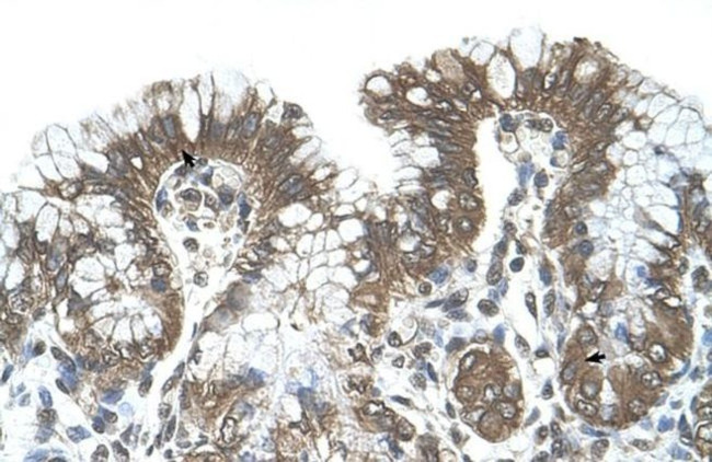 POFUT2 Antibody in Immunohistochemistry (IHC)