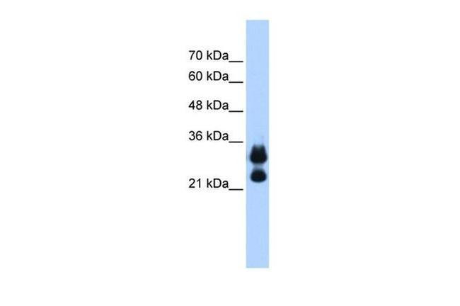 Histone H1.2 Antibody in Western Blot (WB)