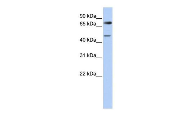 DTL Antibody in Western Blot (WB)