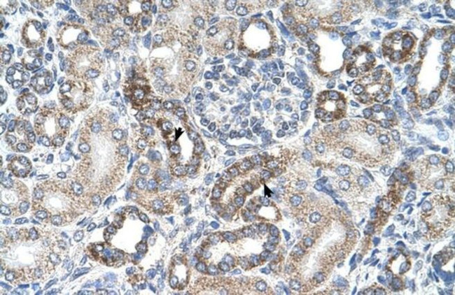 UST Antibody in Immunohistochemistry (IHC)