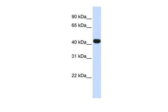 HS3ST3B1 Antibody in Western Blot (WB)