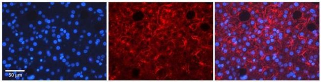 TMED1 Antibody in Immunohistochemistry (Paraffin) (IHC (P))