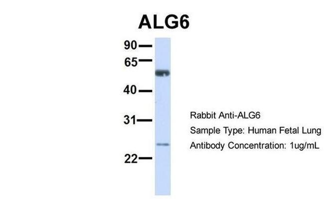 ALG6 Antibody in Western Blot (WB)