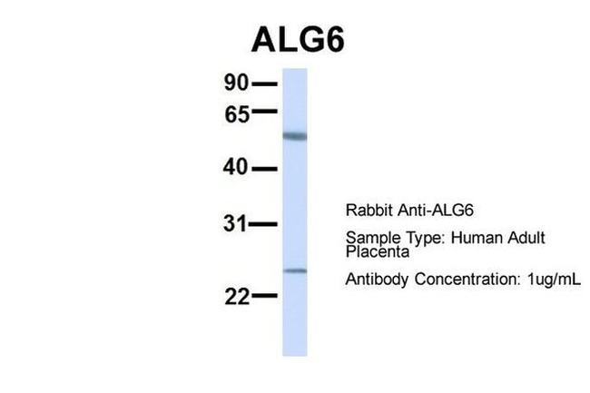 ALG6 Antibody in Western Blot (WB)