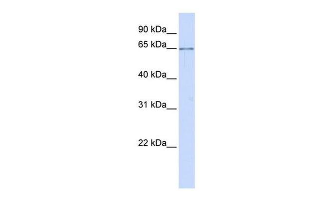 ALG6 Antibody in Western Blot (WB)