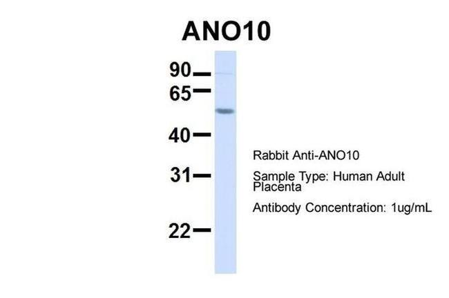 TMEM16K Antibody in Western Blot (WB)