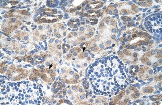 SLC14A1 Antibody in Immunohistochemistry (IHC)