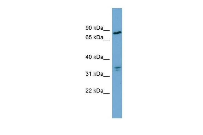 APEH Antibody in Western Blot (WB)