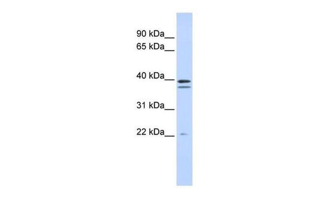 RABGGTB Antibody in Western Blot (WB)