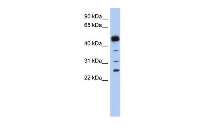 HPGDS Antibody in Western Blot (WB)