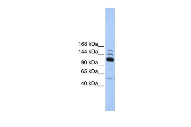 POLR3B Antibody in Western Blot (WB)