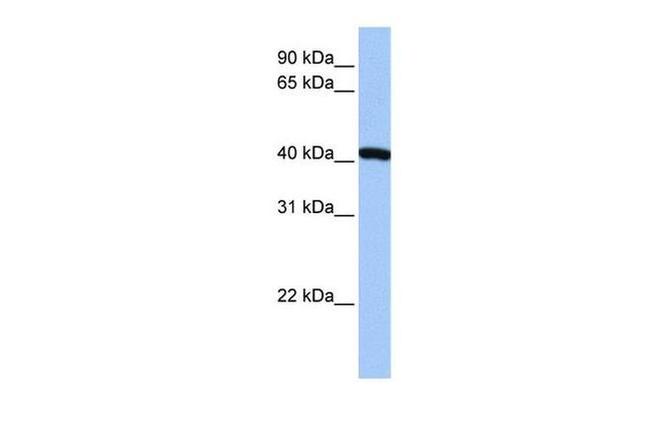 FTSJ1 Antibody in Western Blot (WB)