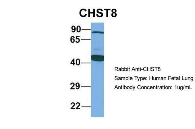 CHST8 Antibody in Western Blot (WB)