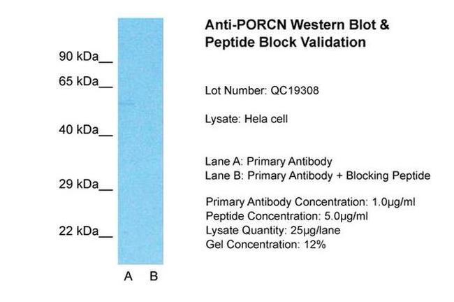 PORCN Antibody in Western Blot (WB)