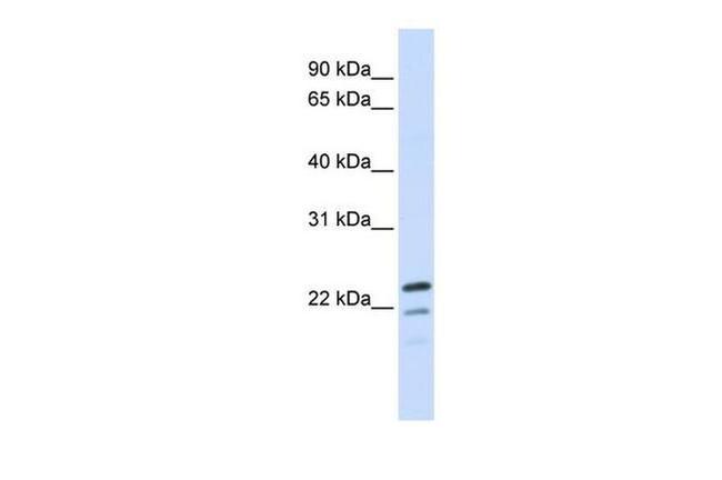 REEP1 Antibody in Western Blot (WB)