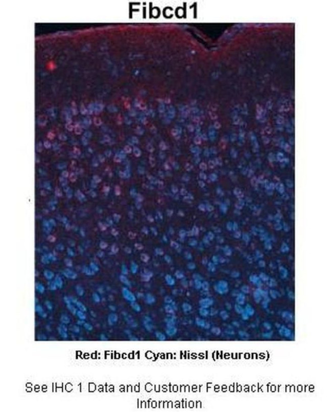 FIBCD1 Antibody in Immunohistochemistry (IHC)