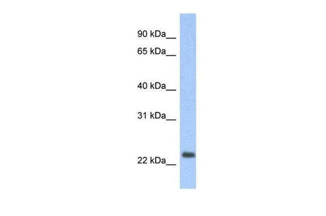 MT-ND6 Antibody in Western Blot (WB)