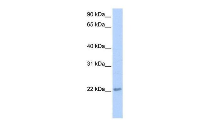 TCEAL2 Antibody in Western Blot (WB)