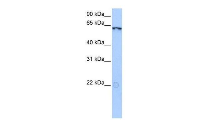 LIN9 Antibody in Western Blot (WB)