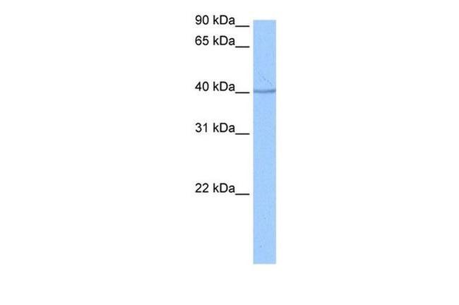 SP6 Antibody in Western Blot (WB)