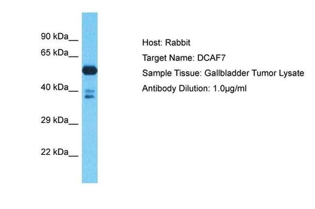 DCAF7 Antibody in Western Blot (WB)