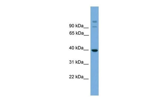 SUGT1 Antibody in Western Blot (WB)