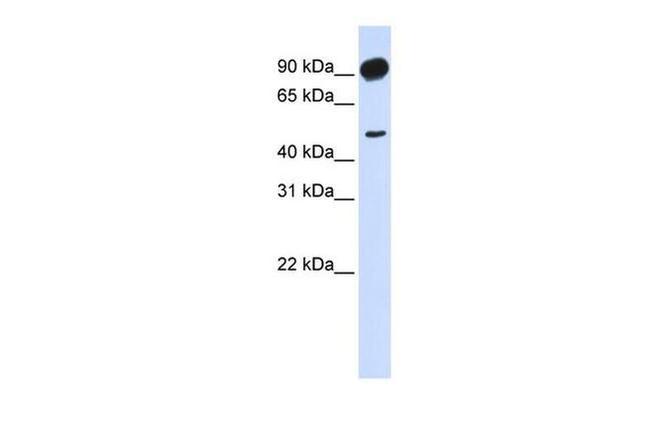 beta Adducin Antibody in Western Blot (WB)