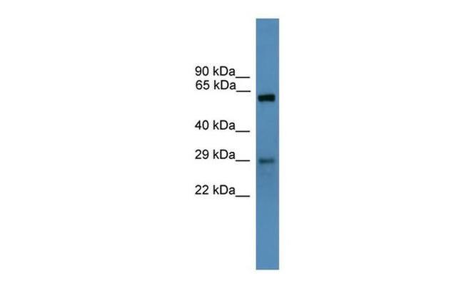 PRPK Antibody in Western Blot (WB)