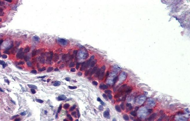 hCV-2 Antibody in Immunohistochemistry (IHC)