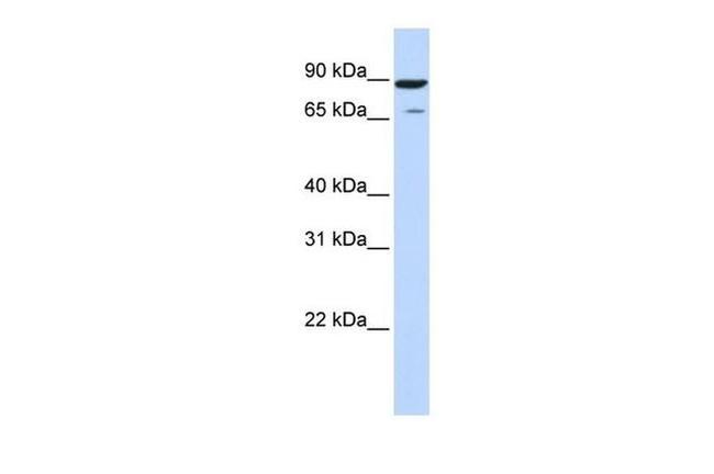 HIPK4 Antibody in Western Blot (WB)