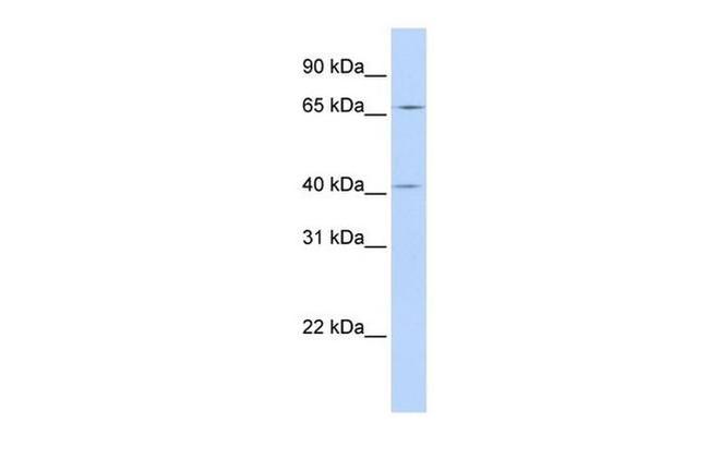 CCDC138 Antibody in Western Blot (WB)