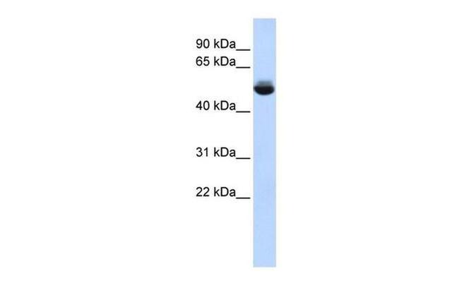 TRAM1L1 Antibody in Western Blot (WB)