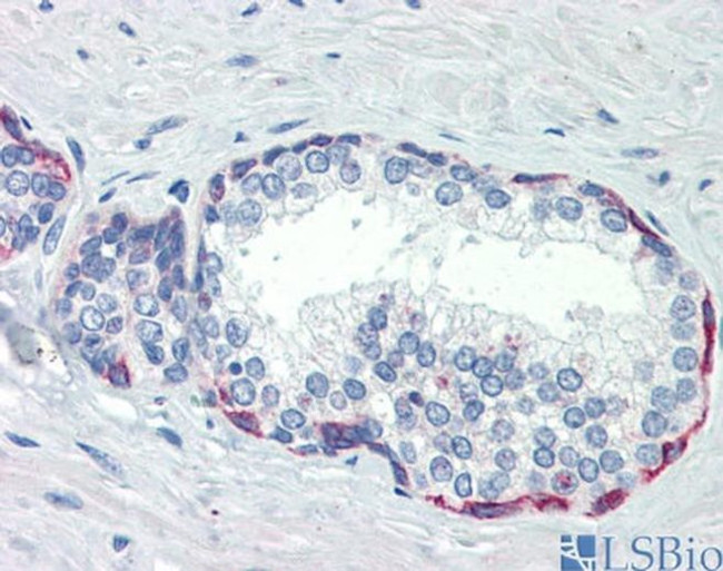 PLEKHH2 Antibody in Immunohistochemistry (IHC)