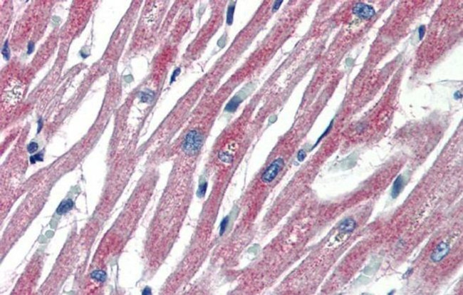 PLEKHH2 Antibody in Immunohistochemistry (IHC)