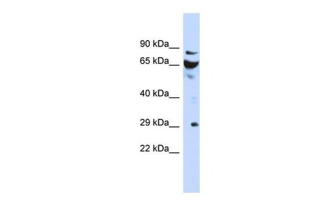 DCUN1D3 Antibody in Western Blot (WB)