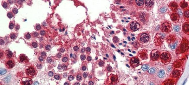 TKTL1 Antibody in Immunohistochemistry (IHC)