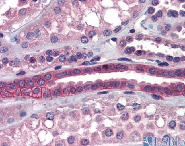 SSX2IP Antibody in Immunohistochemistry (IHC)