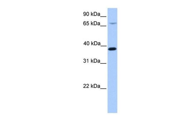 HMBS Antibody in Western Blot (WB)