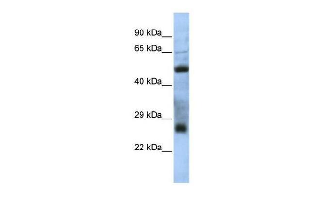 C7orf62 Antibody in Western Blot (WB)