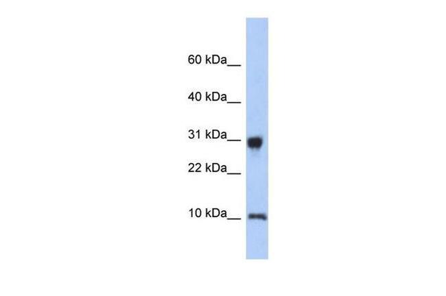 RPS21 Antibody in Western Blot (WB)