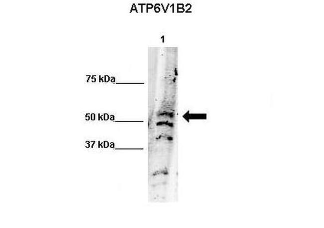 ATP6V1B2 Antibody in Western Blot (WB)