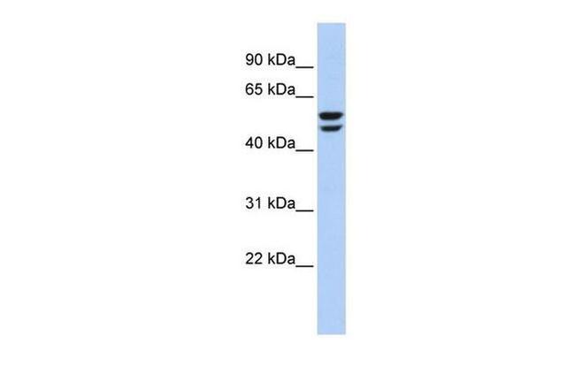 ATP6V1B2 Antibody in Western Blot (WB)