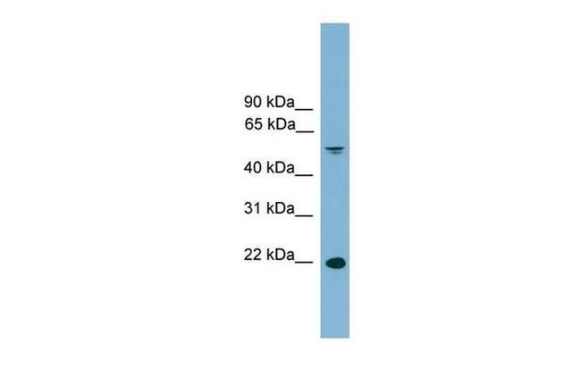 HDGFRP3 Antibody in Western Blot (WB)